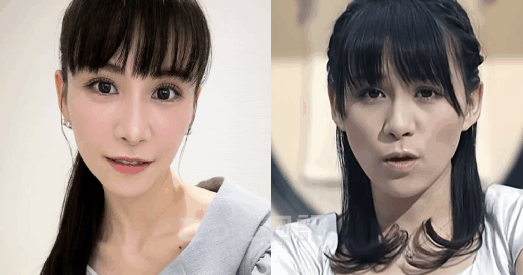 Perfume あーちゃん 整形